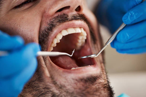 Best Pediatric Emergency Dentist in West Freehold, NJ